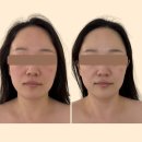 지하철역사 (시청역) | 대전 신부관리 시청역 에스테틱 추천 아로뮤에스테틱