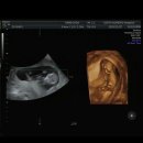 11650-16-12-15 | 임신12주 각도법 이후 16주성별확인 기형아검사 후기