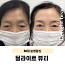 스킨딜라잇 | 60대 눈썹컬러링 김포 풍무동 딜라잇뷰티