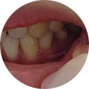 스마일디자인치과병원 | 경기광주 스마일디자인치과병원 임산부 충치치료