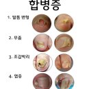 쵸코네일