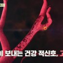 [닥터의 경고, 고혈압] 45세 이상 유병률 1위! 뇌졸중, 심부전 등의 합병증 위험. 돌연사를 부를 수 있는 질환?... 이미지