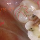 의정부본플란트치과의원 이미지