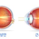 새로본안경(덕소) 네이버블로그