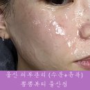 뽐뽐뷰티 | 울산 피부관리 뽐뽐뷰티에서 물방울초음파로 수분 윤곽 한 번에 잡기