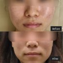 서신동-10(서신길공원) | 전주피부관리 | 서신동 피부관리샵 "시나뷰티" 후기