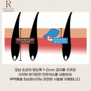 리즈모의원 이미지