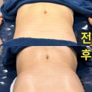 LG동수원자이(아) | “강릉에스테틱 고민 끝! 허리·배둘레 눈에 보이게 줄어든 클라리스스킨랩 내곡자이점 후기”