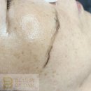담플레닝 티스토리