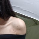 마뜰한의원 네이버블로그