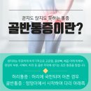 역골로 이미지