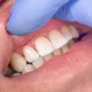 시온치과기공소 이미지