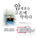 암재발,전이와 부작용이 거의 없는 고주파온열암치료 이미지