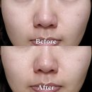 그린영 | 브링그린 티트리 시카 3종 후기, 수부지 추천 올리브영 7월 할인 소식