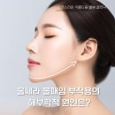 정상사진실 | 울쎄라? 볼패임 부작용 없이 갸름 탱탱해지는 법