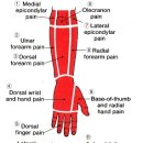 Elbow to Finger Pain-and-Muscle Guide 이미지