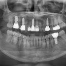신세계치과기공소 이미지