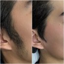 송원서로2L-4 | 남자 구레나룻+눈썹 왁싱, 깔끔함의 차이가 이미지를 결정합니다 (구미 송정동 달미뷰티