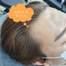 원향미용실 | 울산딜리버즈뷰티 30대남자M자탈모 / 탈모치료하는 3가지