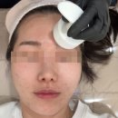 대세한의원 | 해운대 센텀시티 피부한의원 여드름치료 스킨부스터 PN리빌더 T로 해결