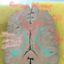 horizontal& coronal section 이미지