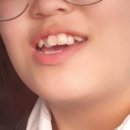 치과 추천] 고등학생 교정 후기｜구미 원호치과 상담부터 진행까지(문성교정치과추천)(봉곡교정치과...