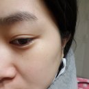 에센메디칼솔루션스(주) | 1분필링 홈케어 메디컬 닥터에스떼Rx밀크필 더마 스페셜 리얼 고트 밀크필 프로그램(미백케어 셀프피부...