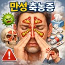 미래웰 생활건강 | 만성 축농증 잡고 수면과 집중력까지 되찾은 아들 후기