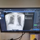 [설치] 김포 통진읍 코앤이비인후과 Portable X-ray &amp; DR