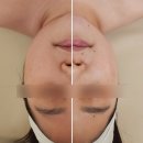 피부에오광(光) | 순천 피부관리샵 추천)내돈내산 피부에 오광 가격/후기