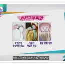 TV조선 생방송-회전근개파열 치료방법(4부) 이미지