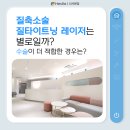 바람케이의원 | 질축소술 질타이트닝 레이저는 별롤까? 수술이 더 적합한 경우는?