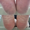 솜솜네일 네이버블로그