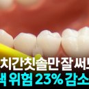치실•치간칫솔의 중요성 이미지