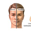 신월맥한의원 이미지