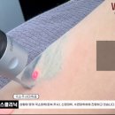 오투피부과의원 | 수원 문신 제거 가격, 후기, 흉터 걱정 끝! 피코 레이저로 깔끔하게 지우는 비결 (원스의원)