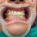 참플란트치과의원 이미지