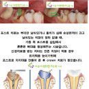 아중이편한치과 네이버블로그