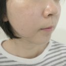 세심 | 광교 웨딩관리 아바에스테틱 꼼꼼하고 세심했던 관리 후기