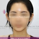 모앤라인성형외과의원 네이버블로그