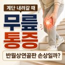 송파굿정형외과의원 | 송파나루역정형외과 계단 내려갈 때 무릎 통증, 반월상연골판 손상일까?