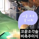 샤프(SHARP)성형외과의원 | 20대 남자 코수술, 티 안 나게 잘 되는 법? (feat. 해부학 박사가 알려주는 코끝조각술)