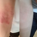 주식회사 젠바이오 이미지