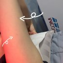 라미한의원 | 신부관리 압구정 다이어트한의원에서 비비주사 추천 / 팔뚝, 복부 지방분해약침 후기 포함