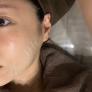 마곡휴연합의원 | 슈링크 마곡 비아프의원 솔직 후기 /내돈 내산 /리프팅 추천