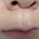 티업의원 이미지