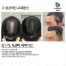 디블랙아카데미진주점 | 진주두피 두피 고민, 디블랙에서 해결했어요