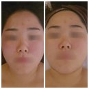 휘닉스파크관광단지 | 평창마사지 피부관리 촉촉수분케어 후기, [금송테라피]