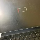 가톨릭대성빈센트병원 | 난소기형종 복강경 수술후기 #2 - 가톨릭대 성빈센트병원 / 수술후부터 퇴원까지