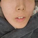 CU로데오 | 압구정 로데오 피부과 줄기세포 스킨부스터 통증 후기 효과 셀리크의원